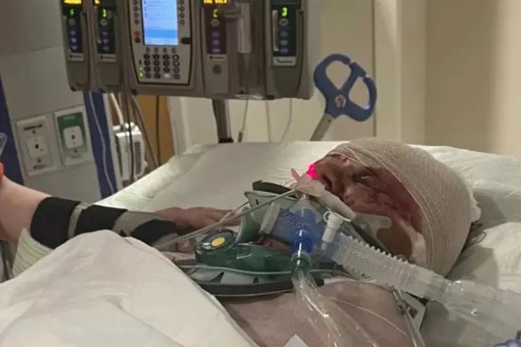 ‘Nothing but the bone left’ on her arm: Deputy recounts gruesome South Carolina pit bull attack