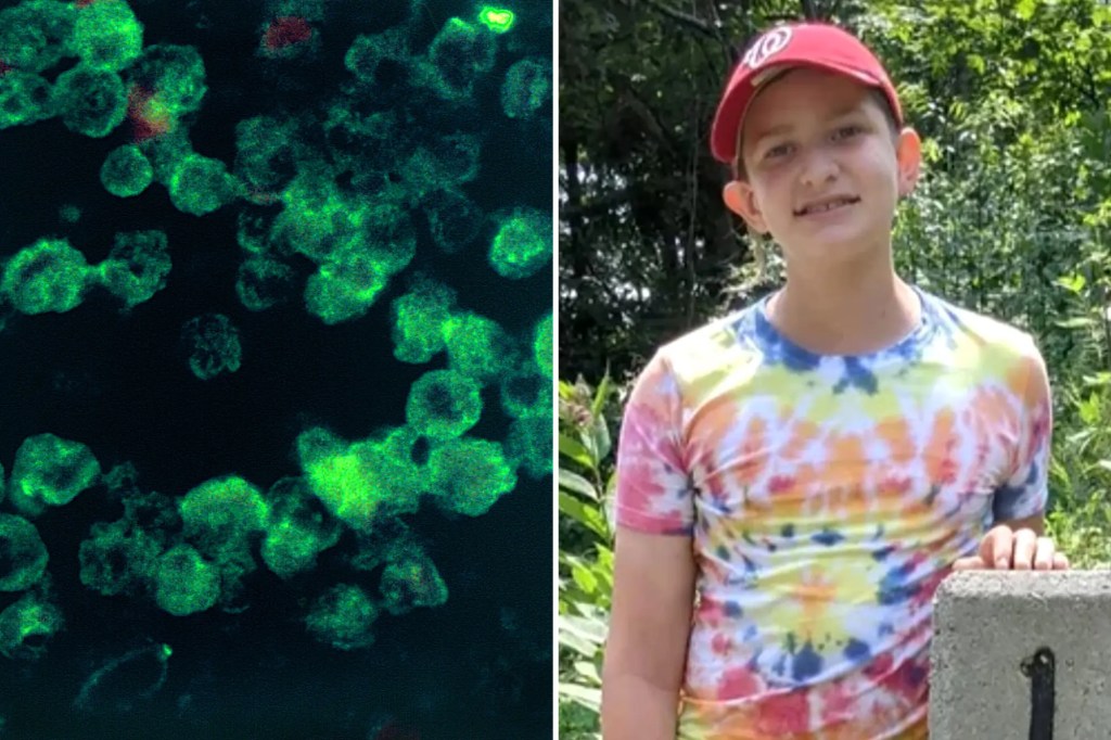 Teen swimmer battling deadly, brain-eating amoeba, ‘fighting his little heart&nbsp;out’￼