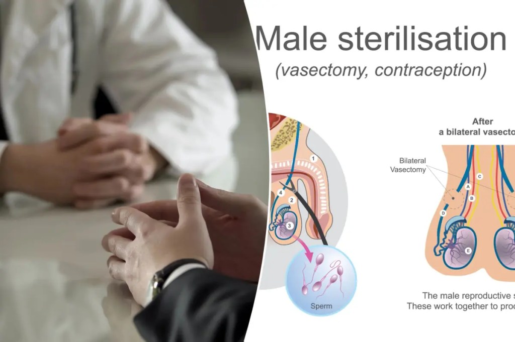 More young men are getting vasectomies, study&nbsp;reveals