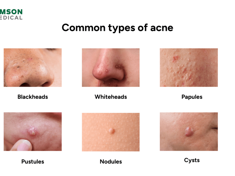 Understanding Skin Conditions: Common Issues and How to Address&nbsp;Them