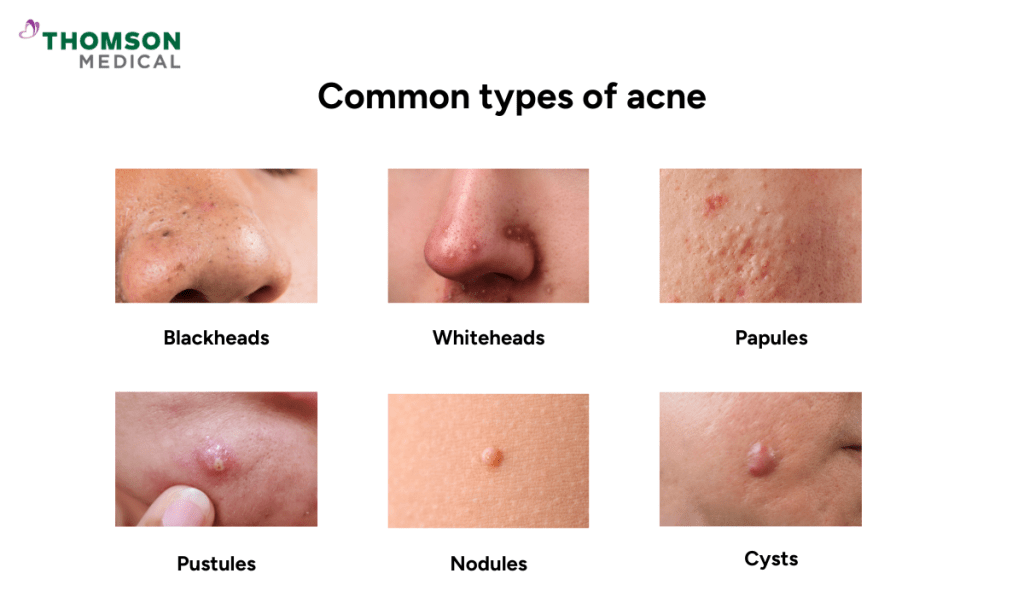 Understanding Skin Conditions: Common Issues and How to Address&nbsp;Them